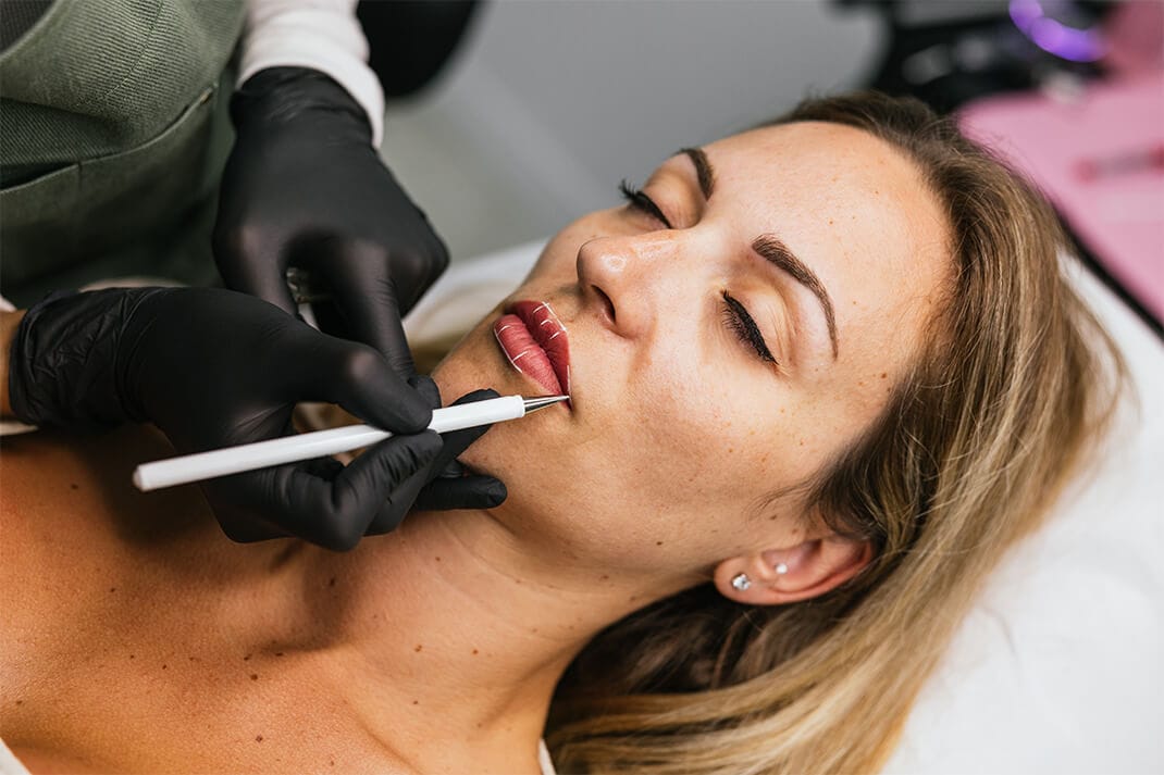 Liplift in Turkije - Prijs, Voor en Na en Reviews